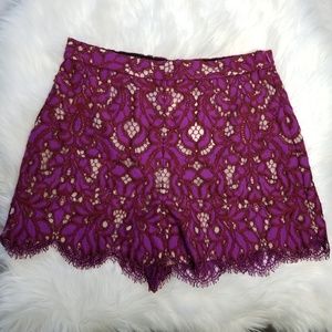 Diane Von Furstenberg Scallop Lace Overlay Shorts